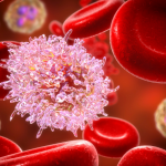 【ASCO2022】BMS社再発/難治性大細胞型B細胞リンパ腫対象治療薬ブレヤンジ第2相結果を発表