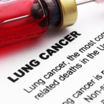 ASCO2022「肺がん」で注目の演題は、ミラティ社のアダグラシブとTIGIT免疫療法チラゴルマブ